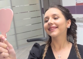 Виправлення прикусу у Запоріжжі: які брекети обрати для ідеальної посмішки?